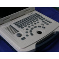 DW-580 ultrasound pregnancy & ultrasound scan machine